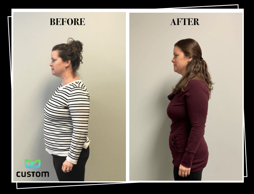 Weight Loss Rochester NY Patient Testimonial